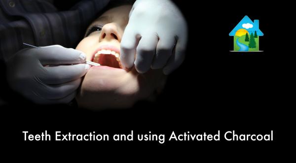 Teeth Extraction and Using Activated Charcoal