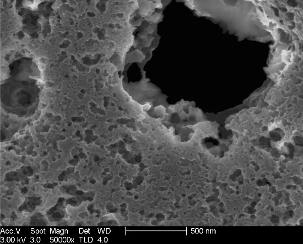 What Is Activated Charcoal 